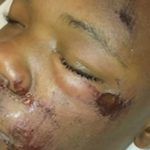 USA : un adolescent tabassé par la police lors de son arrestation… pour avoir vapoté