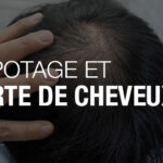 elfbar nachfüll pod läuft aus Cigarette électronique : Pourquoi ces troubles digestifs ? main image 0