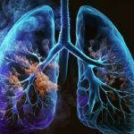 Une nouvelle étude poubelle sur la cigarette électronique