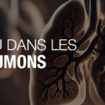 elfbar nachfüll pod läuft aus La cigarette électronique… une bombe à retardement pour les poumons !