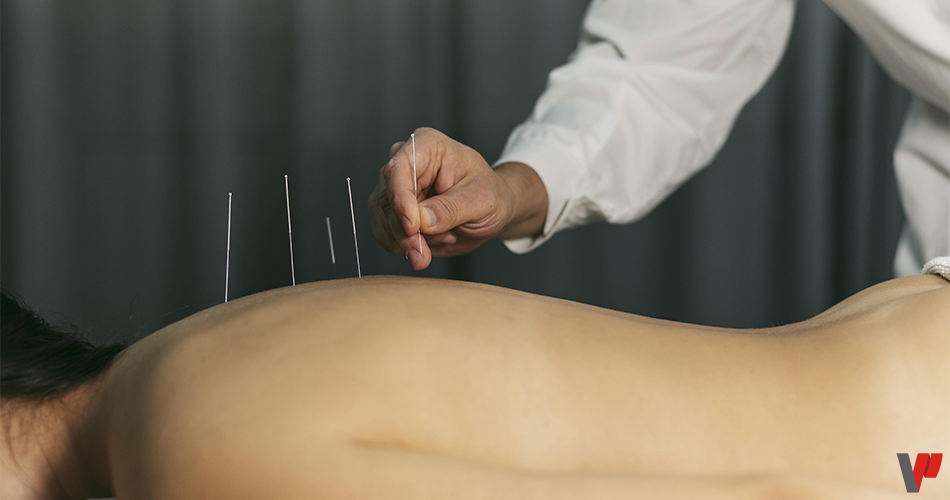 Un homme chez l'acupuncteur